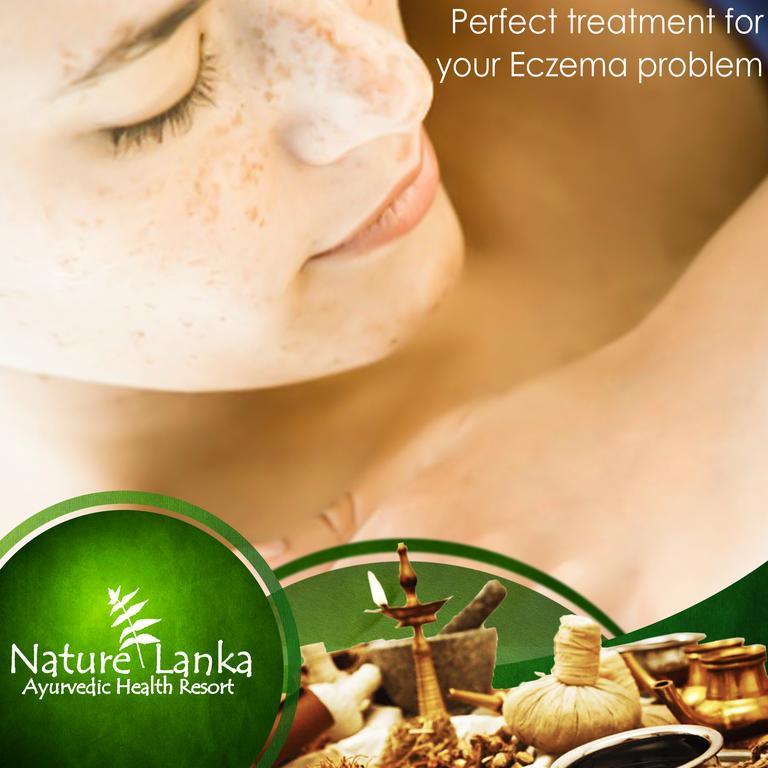 Nature Lanka Ayurveda Resort - All Meals And Ayurveda Treatments With Yoga 탕갈레 외부 사진